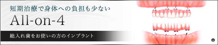 All-on-4